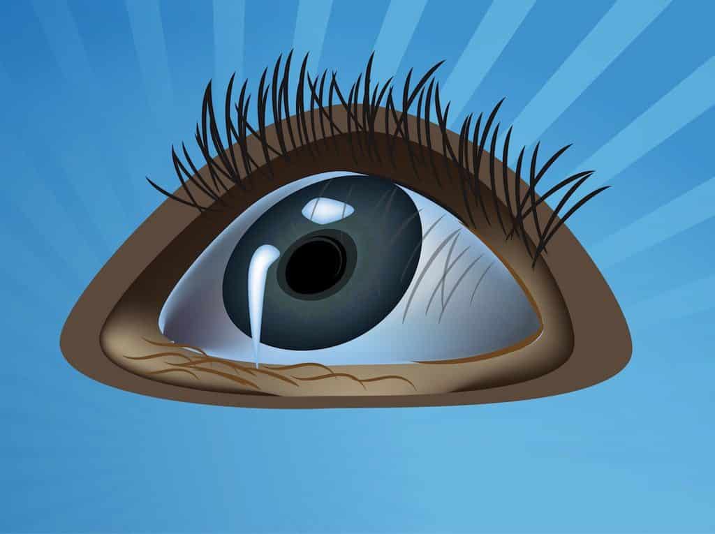 Staring-Eye